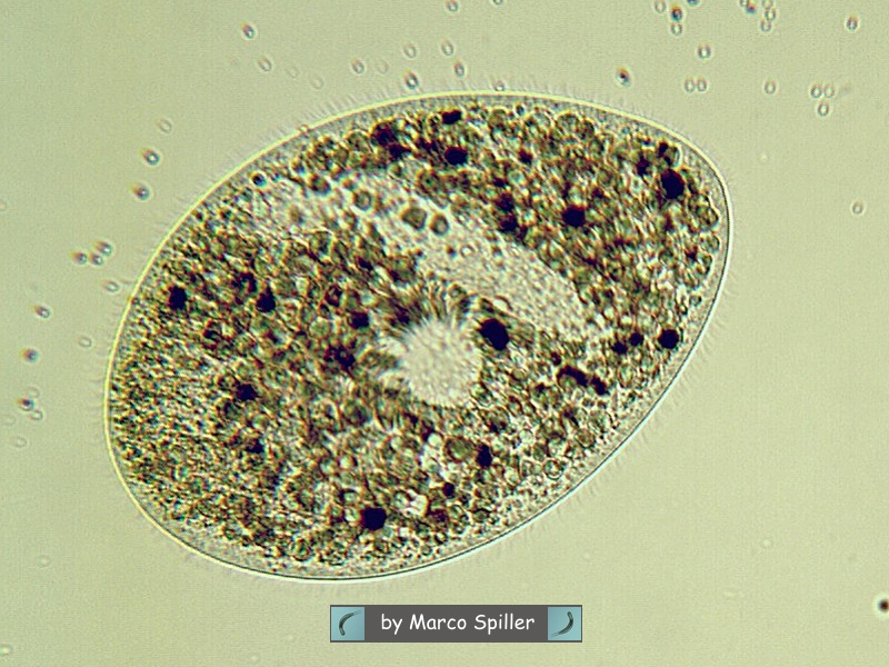 Ophryoglena atra